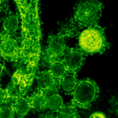 Peptide database opens new treatment possibilities*March 2025: Study by Prof Yifat Merbl’s lab at the Weizmann Institute of Science has revealed that the proteasome, a protein complex in cells, not only breaks down damaged proteins but also produces antimicrobial peptides that combat bacterial infections